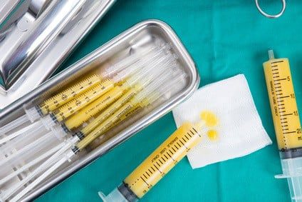 Zoom sur le lipofilling ou lipostructure