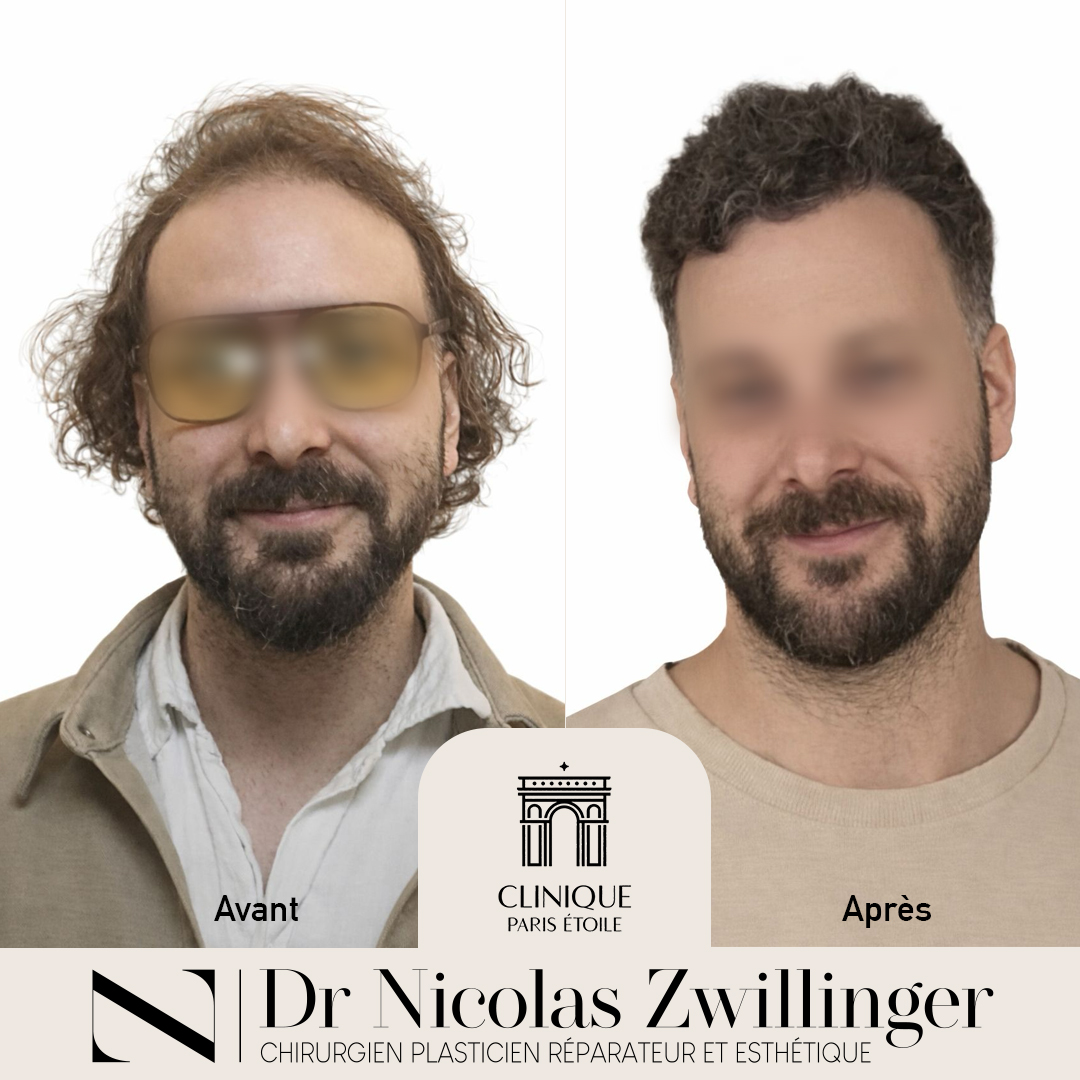 Before and After – 3 Days to Go