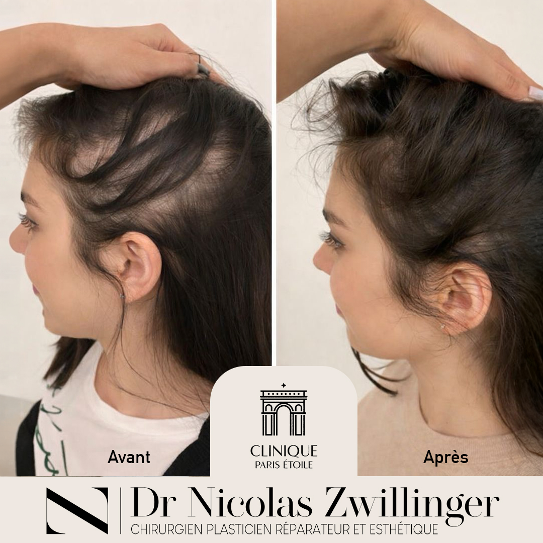 Before and After – 4 Days to Go